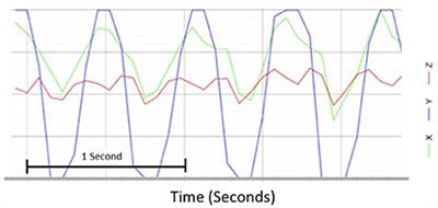 Head shaking does not alter vestibulo ocular reflex gain in vestibular migraine